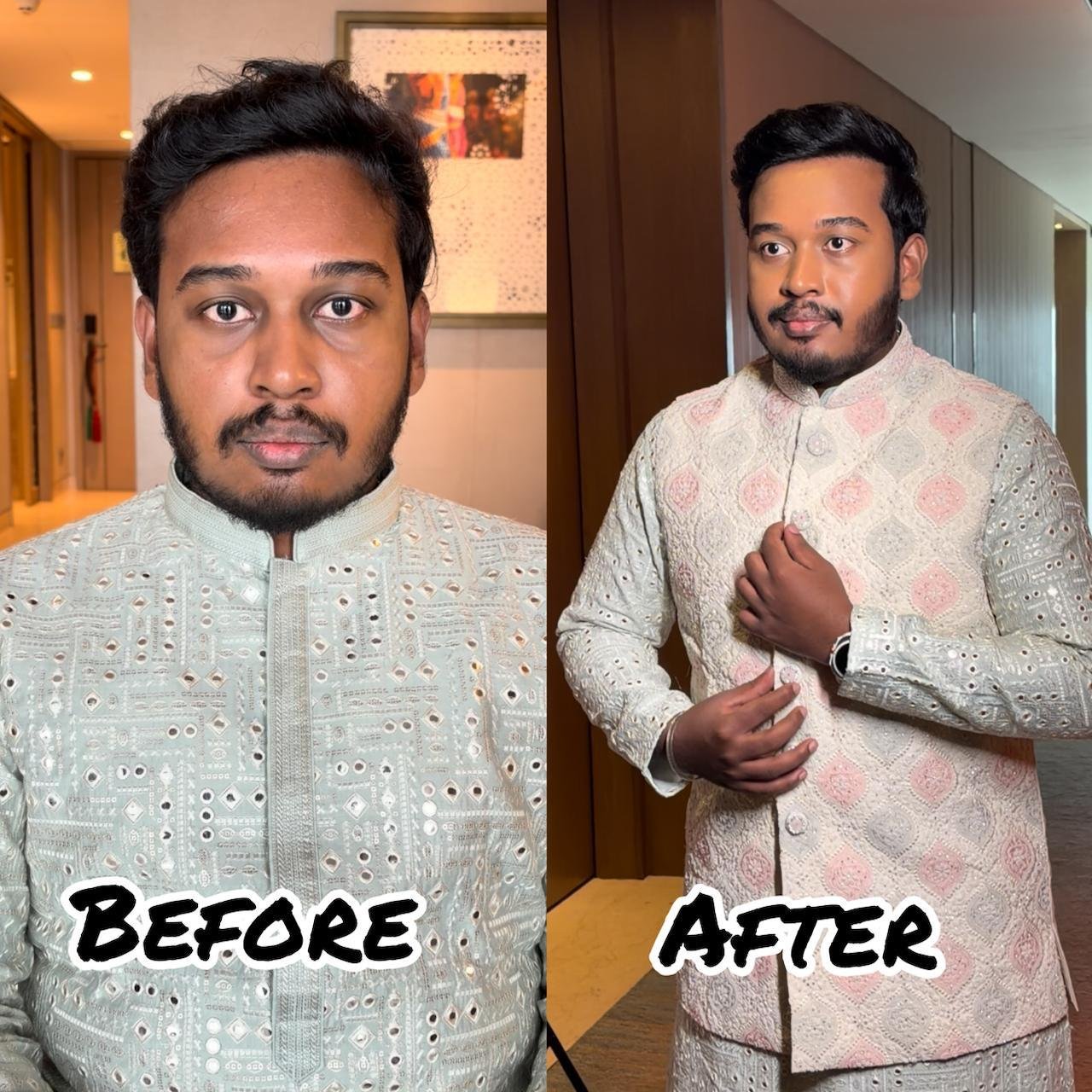 Groom Makeup Before After Chennai
